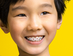 boy with stickables on his invisalign aligners
